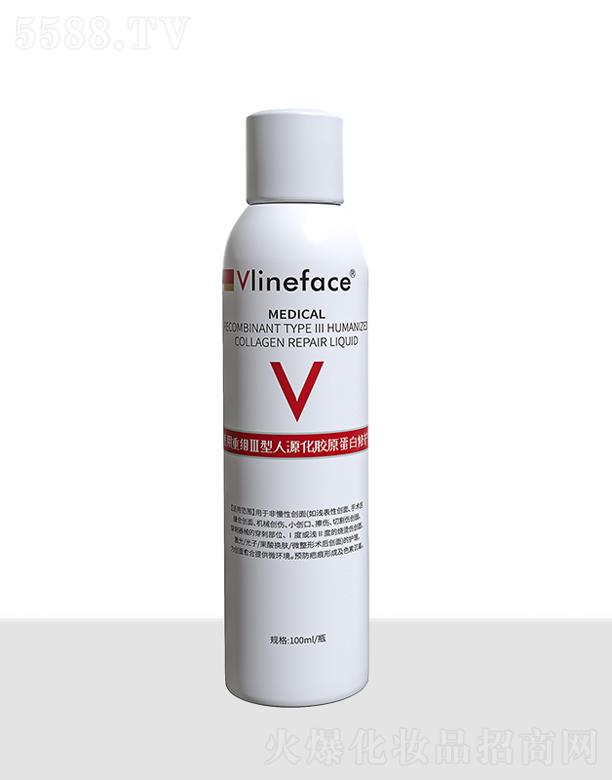 Vlinefacet(y)ؽMԴzԭo(h)Һ